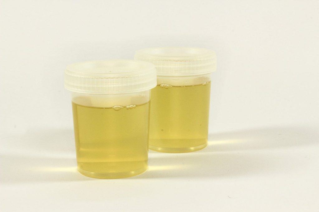 Urine bottle